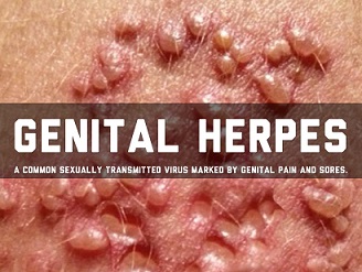 hpv herpes genitalis